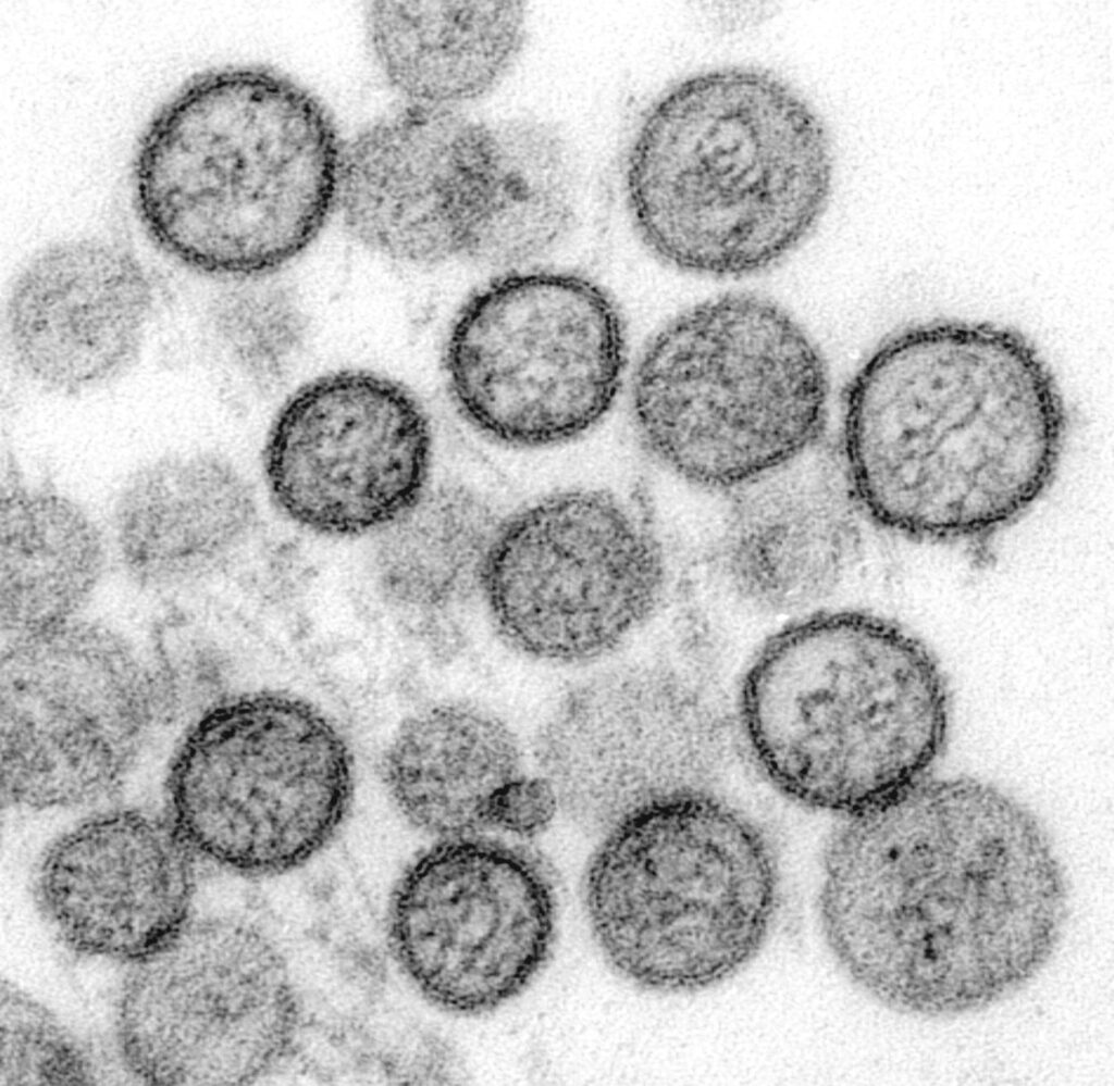 Orthohantavirus microscopie electronique