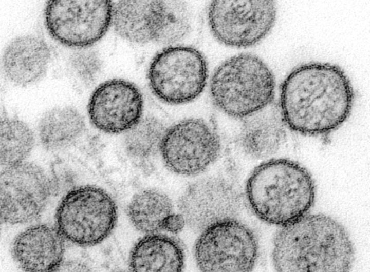Orthohantavirus microscopie electronique